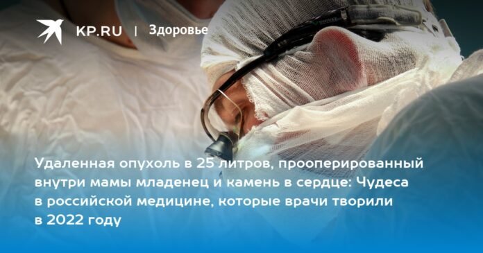 A 25-liter tumor removed, a baby operated inside the mother and a stone in the heart: Miracles in Russian medicine performed by doctors in 2022

