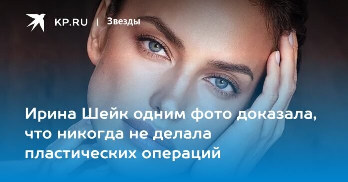 Irina Shayk Showed With A Photo That She Has Never Had Plastic Surgery 